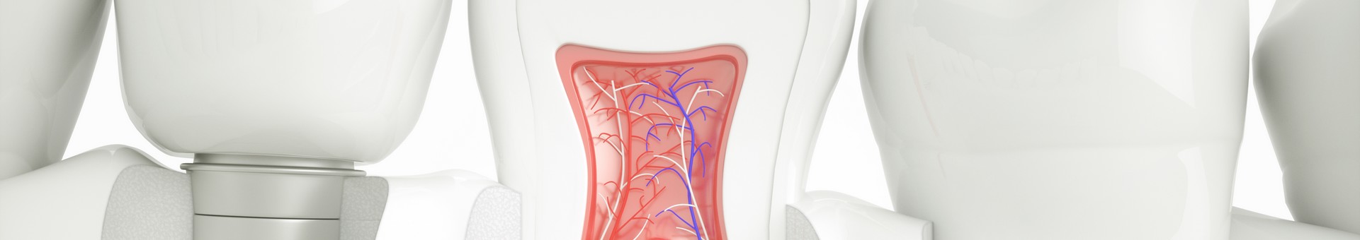 Zahnimplantate stellen bei korrekter Planung, richtiger Pflege und regelmäßiger Nachsorge eine langzeitstabile Lösung dar.