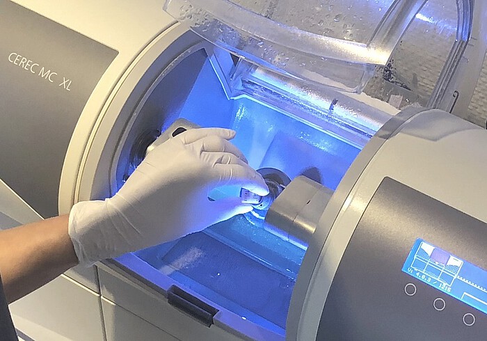 CEREC® Behandlung